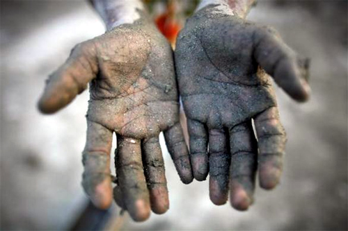 ota Miya, 10, shows his hands after preparing soil to make bricks in a brick field on the outskirts of Dhaka.