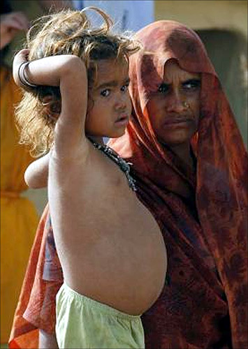 Four-year-old Kiran, who is suffering from malnutrition, stands next to her mother Sheil Rani in Balabehat village in Lalitpur district, in Uttar Pradesh.