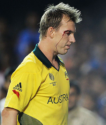 Brett Lee goes off the field, after injuring his eye while fielding on the boundary line