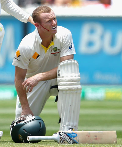 Chris Rogers of Australia recovers after he was struck in the head by a delivery from Stuart Broad of England