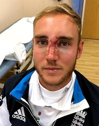 Stuart Broad