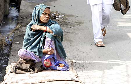 A woman suffering from leprosy waits for alms on a roadside on the occasion of anti-leprosy day