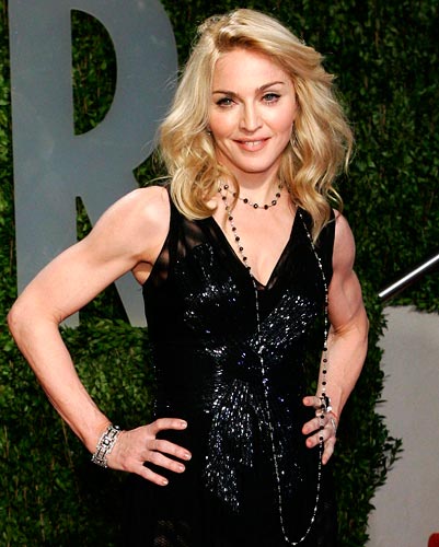 It's alleged that Madonna gets Botox done regularly -- if you're following in her footsteps, be prepared for a little bruising