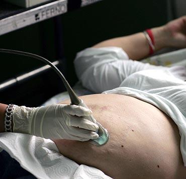 An ultrasound machine being used to take images of a baby