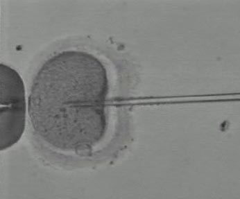 A micropipette is used to inject the sperm into the egg