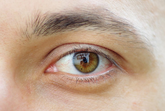 Allergic reactions involving the eyes are a common complaint