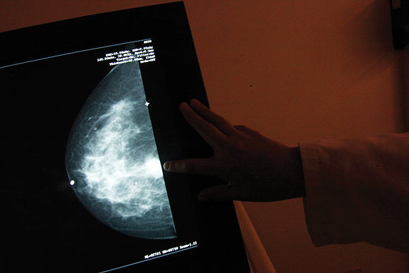 A monitor shows the image of a breast cancer at a centre run by the Reto Group for Full Recovery of Breast Cancer in Mexico City October 18, 2012. Breast cancer has been the leading cause of death in Mexican women since 2006, according to the group. The World Day Against Breast Cancer is commemorated on October 19.