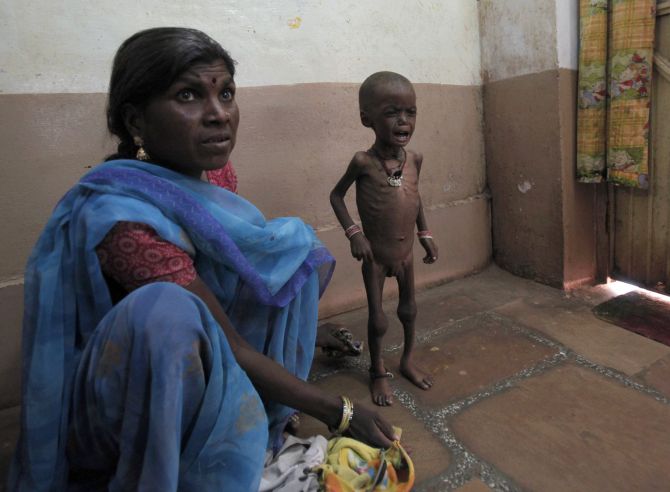 Severely malnourished two-year-old girl Rajni waits with her mother at the Nutritional Rehabilitation Centre of Shivpuri district.