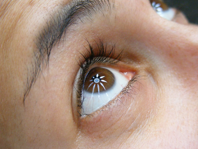 What is dry eye syndrome? Do you have it?