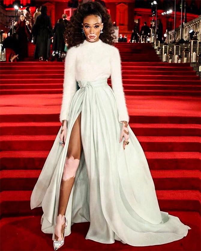 British Fashion Awards Winnie Harlow