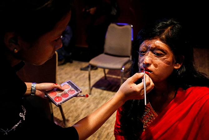 Acid attack show in Bangladesh