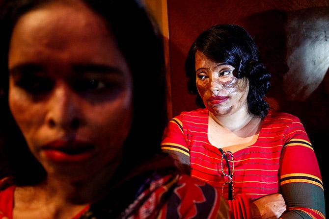 Acid attack show in Bangladesh