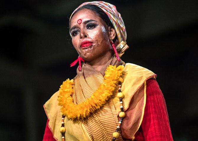 Acid attack survivor