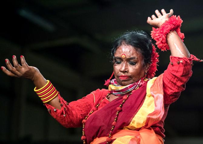 Acid attack survivor on the ramp