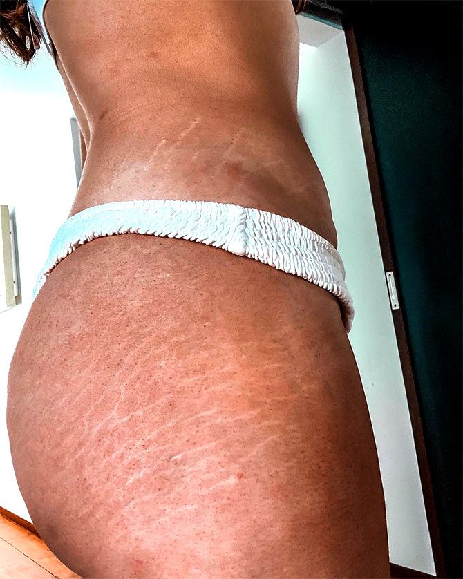 Rozanna Purcell flaunts her stretch marks. 