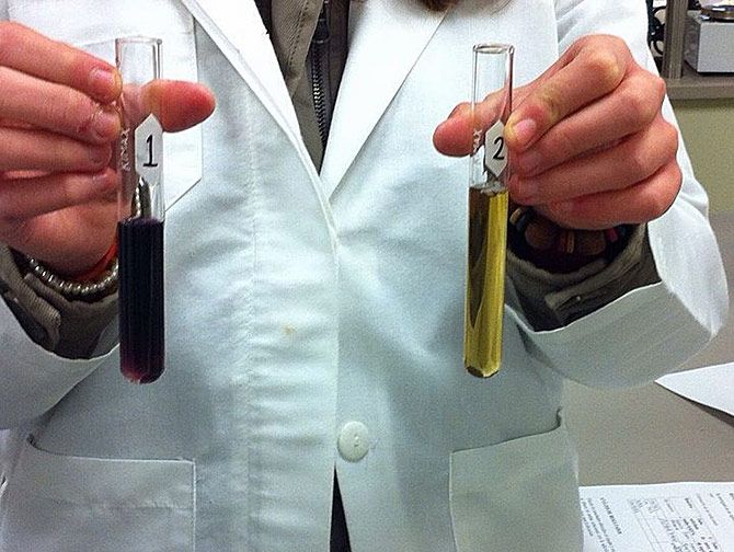 What the colour of urine says about your health