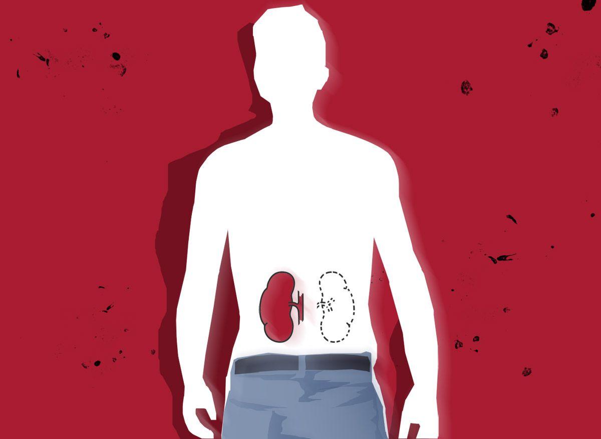 How To Live Healthy With One Kidney? Ask rediffGURUS