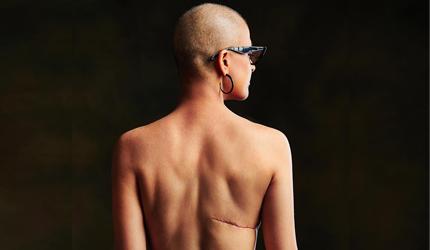 breast cancer after mastectomy: is it possible?