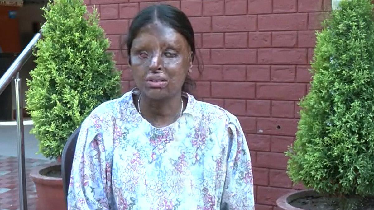 Acid attack survivor and CBSE 2025 topper Kafi