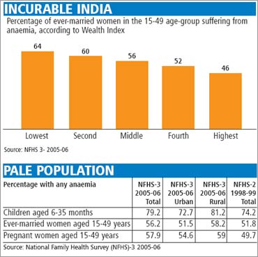 India loses 1.27% of GDP annually due to anaemia