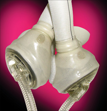 SynCardia's Total Artificial Heart.