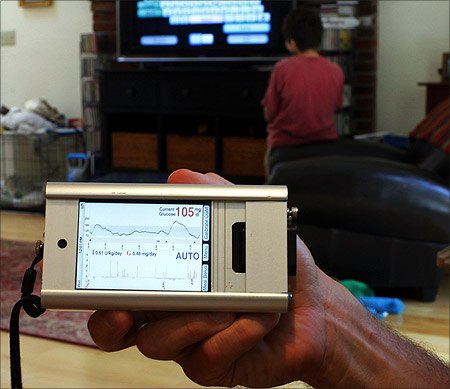 Ed Damiano holds up the prototype for the portable monitor for a bionic pancreas at the family's home in Acton, Massachusetts.