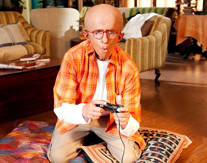 Bald actor? Hit hai, boss! - Rediff.com movies