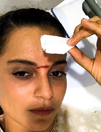 Kangana Ranaut gets injured on the sets of Manikarnika - Rediff.com