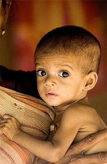 A woman holds her malnourished grandson in Mumbai