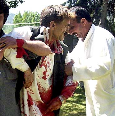 An injured man is assisted at the site of a suicide bomb attack in Timergarah, situated in Lower Dir district of Pakistan's restive North West Frontier Province on Monday.