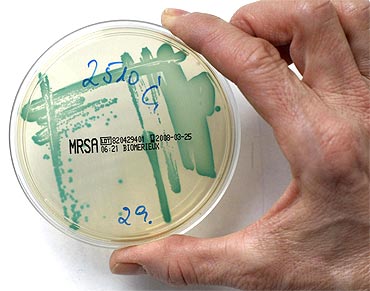 The MRSA (Methicillin Resistant Staphylococcus Aureus) bacteria strain as seen in a petri dish