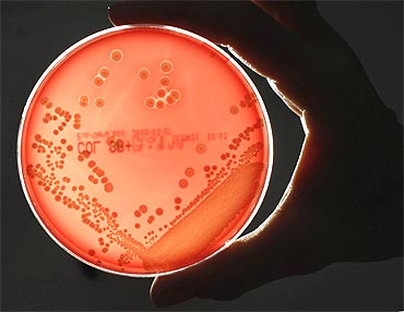 The MRSA 'superbug' bacteria strain