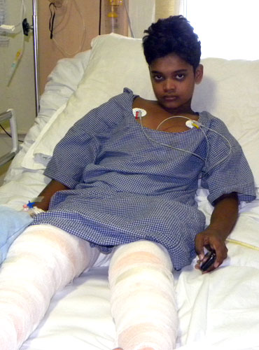 Abhijit Gautam, 12, recovering from gun-shot wounds in a Raipur hospital.
