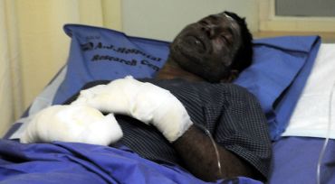 Omar Farook recovers at the A J Hospital and Research Centre on Saturday