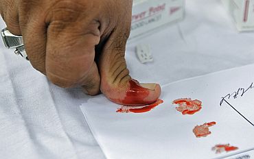 A student signs her support for Anna Hazare with her blood during a rally against corruption in Ahmedabad