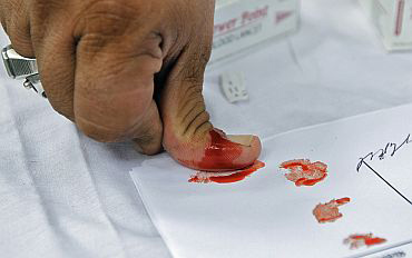 Supporters of Anna Hazare sign a thumb-impression with blood to show solidatity with his cause
