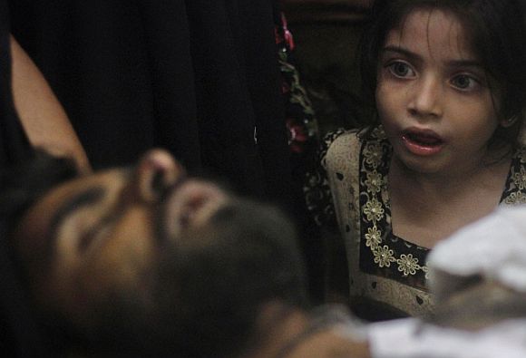 Eight-year-old Sumayya, whose uncle, Imran Ali, was injured in a shootout by unidentified gunmen, looks at him as he is brought to a hospital for treatment in Karachi August 23, 2011