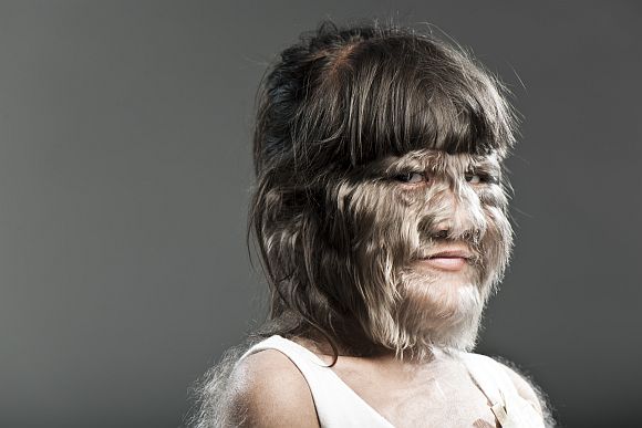 World's Hairiest Girl: Supatra Sasuphan