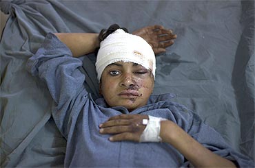 A Pakistani boy injured in a suicide bomb attack at a mosque awaits treatment at a hospital in Peshawar