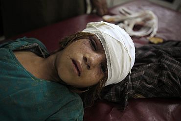 A girl injured by a suicide bomb blast in Pakistan's northwestern Mohmand region lays awaiting treatment at a hospital in Peshawar