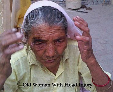 An old woman shows her wound inflicted during the police lathi charge