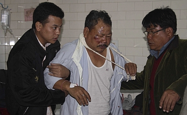 Relatives of a man who was injured after a bridge collapsed at Bijonbari village, is helped inside a hospital in Darjeeling
