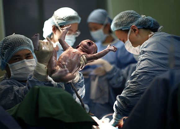 A doctor holds up the newborn baby of Yang Huiqing, 26, as she undergoes a caesarian section at Ruijin hospital in Shanghai