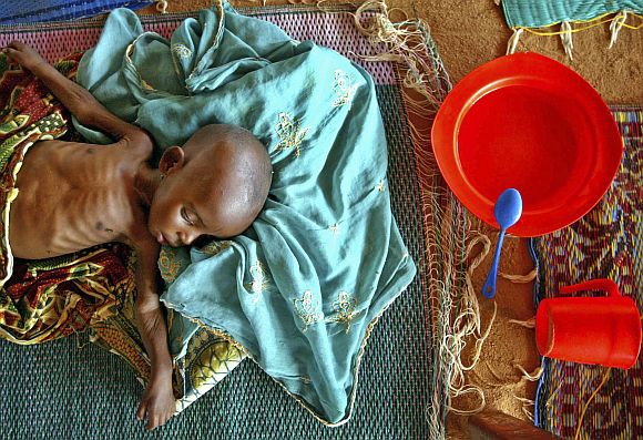 A malnourished infant lies on the floor in a therapeutic feeding center run by the medical charity Medecins Sans Frontiers (MSF) in the town of Maradi in southern Niger