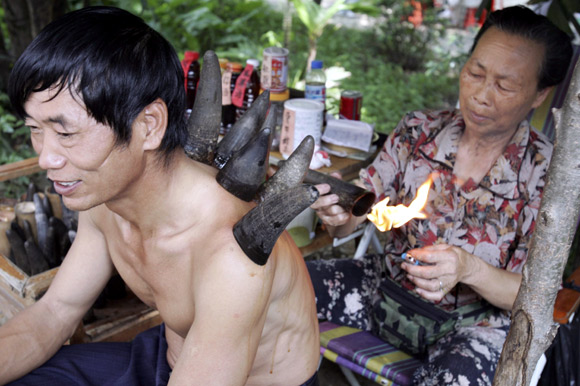 IN PIX: Crazy things people do to get well soon