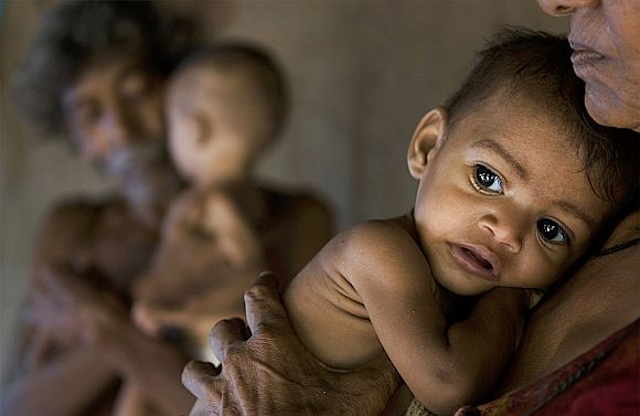 About 45-47 per cent of children in India below the age of five are malnourished by weight, notes Dr Sen.