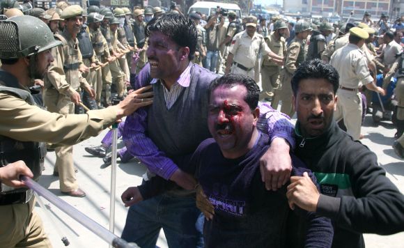 An injured protestor is seen in Srinagar during the second day of the strike by the J&K government employees