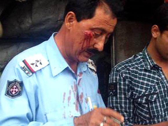Sub-Inspector Mohan Lal after being thrashed by the guards of minister on Monday