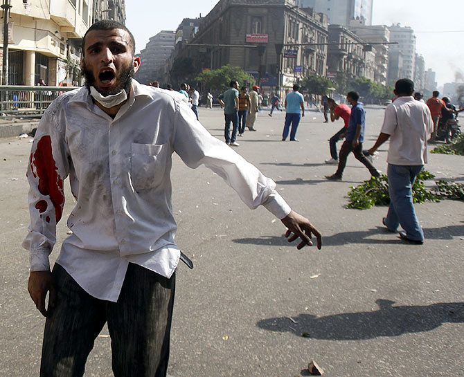 It is a WAR out there in Egypt