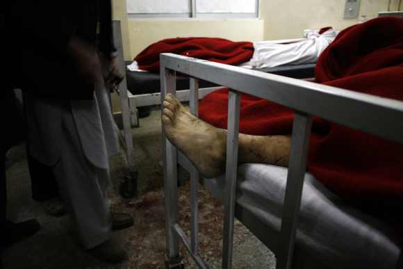 A foot is seen under a blanket at a hospital after the bomb attack in Quetta